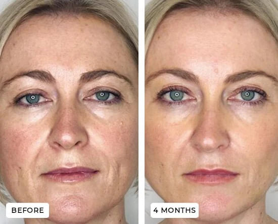 YouthGlow Face & Neck Massager