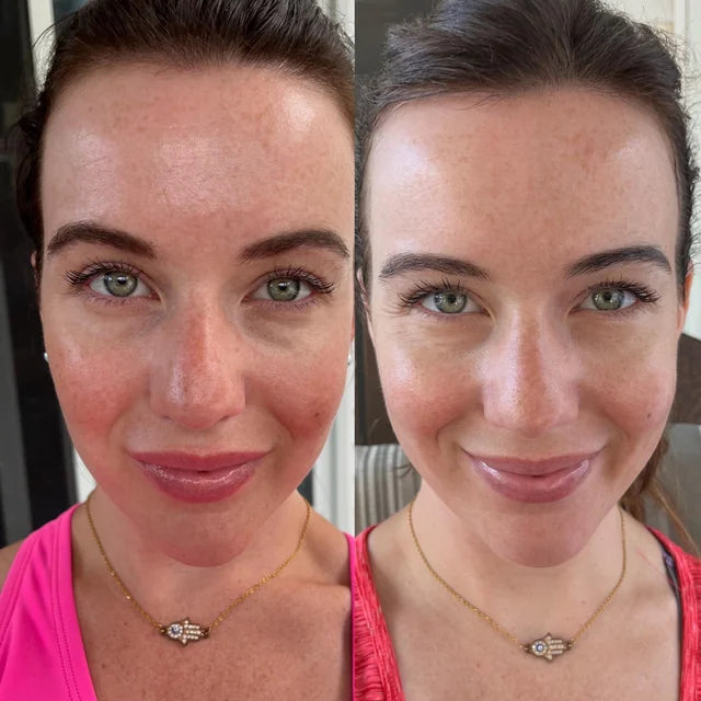 YouthGlow Face & Neck Massager